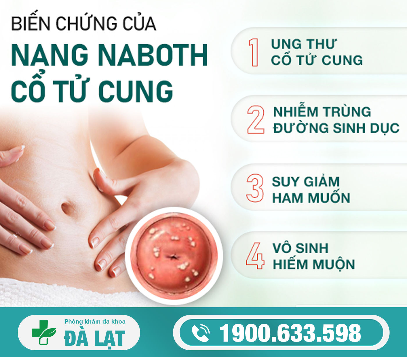 Hình ảnh minh họa